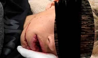 Un joven fue víctima de una golpiza salvaje a la salida de un boliche