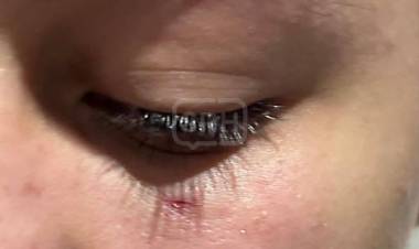 DENUNCIAN AGRESIÓN A UNA ALUMNA EN PASO DE LOS LIBRES